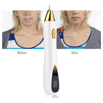 Skin Care Laser Mole Tattoo Freckle Removal Pen